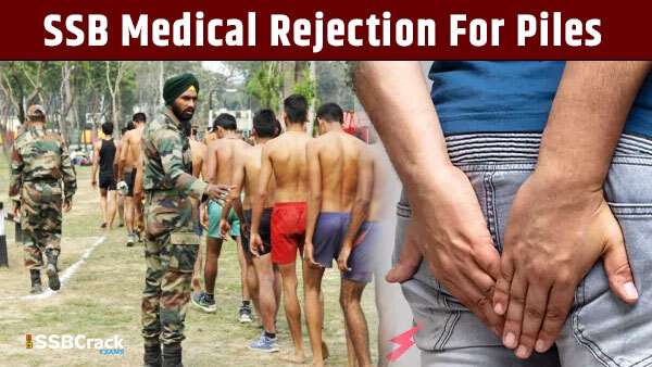 SSB Medical Rejection And Cure For Piles