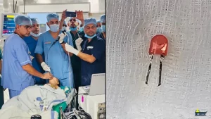 Indian Army Doctors in Pune Save 9-Month-Old Baby After Removing LED Bulb from Lung